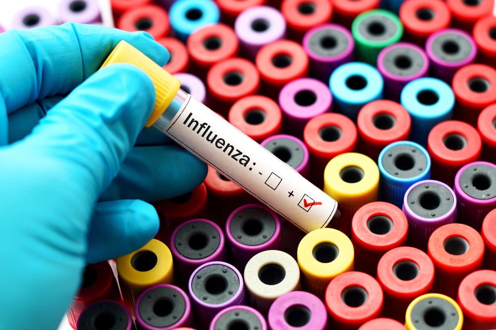 Bệnh Cúm Gà (Avian Influenza)